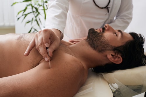 Acupuncture_2